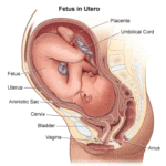 pregnancy