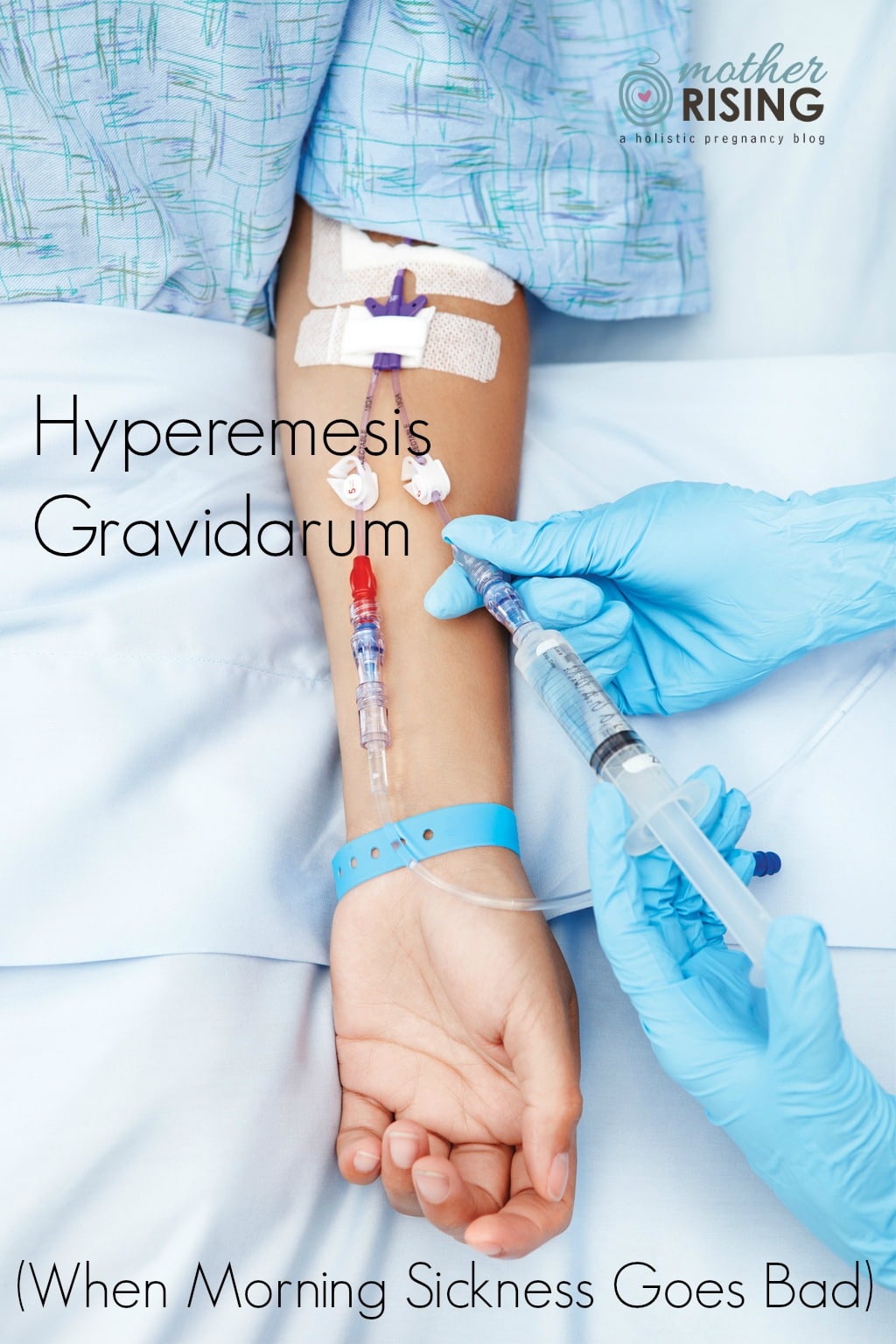 Hyperemesis gravidarum is not morning sickness. HG, as it is commonly referred to, is extreme, persistent nausea and vomiting that can lead to dehydration. If you are experiencing HG, know that what you are experiencing is real, extremely difficult, and you are not alone. 