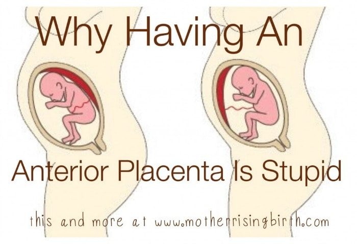 anatomy clipart of pregnant person with anterior placenta vs posterior placenta