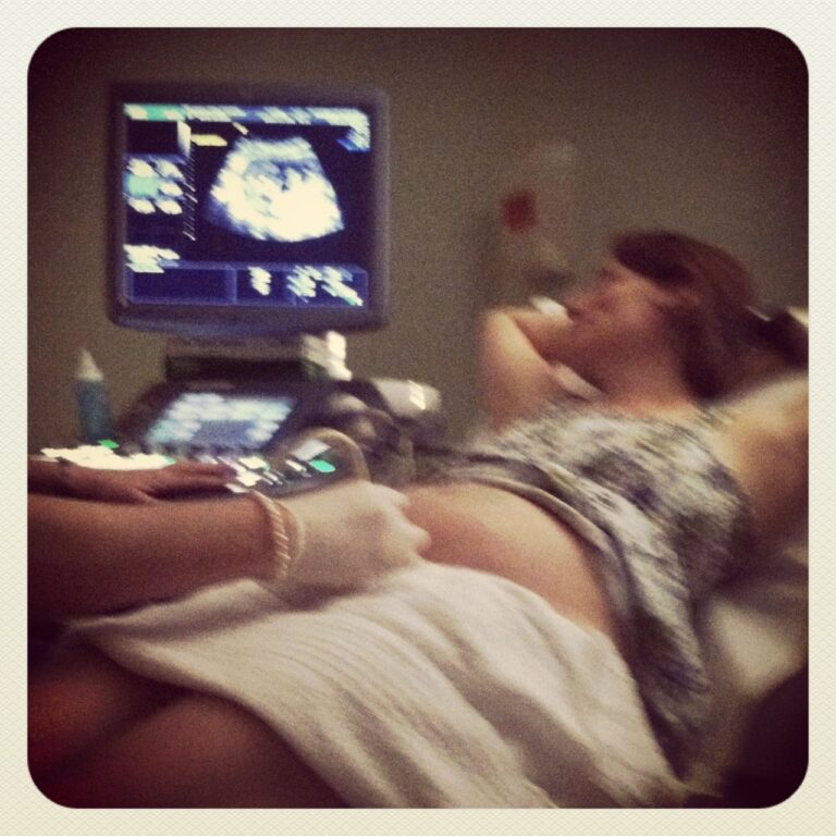 21 Weeks Pregnant Ultrasound