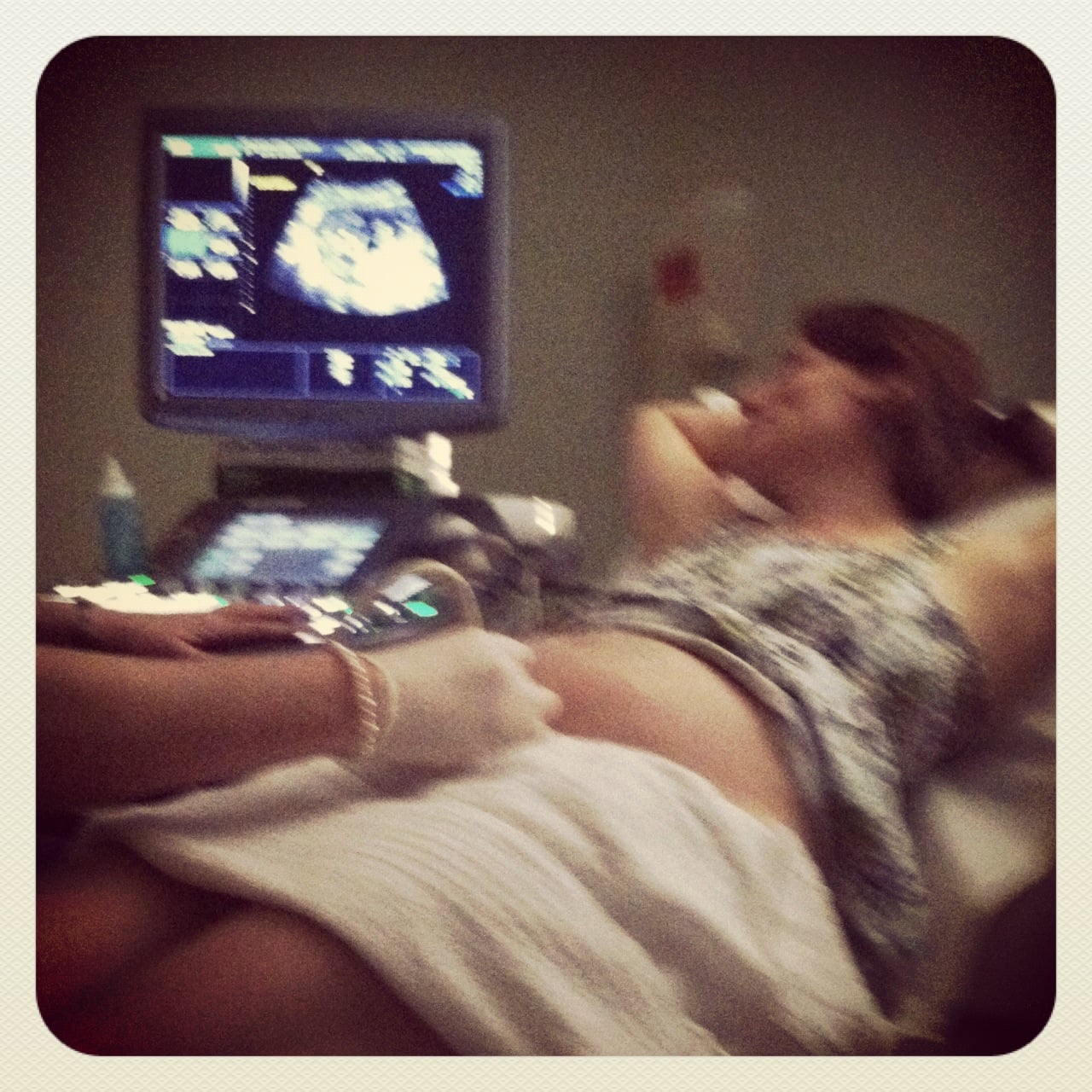 21 Weeks Pregnant Ultrasound