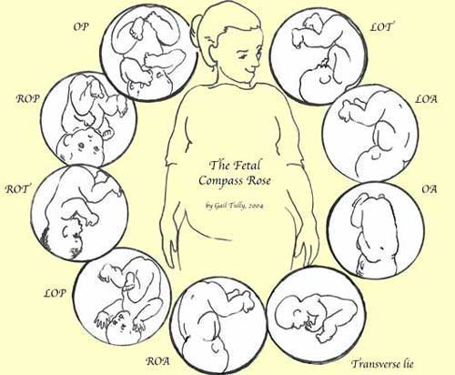 the fetal compass rose showing fetal position variations