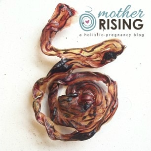 Photo of dried umbilical cord shaped in a spiral on a white background with mother rising logo in the upper right hand corner. Dried umbilical cords typically do not increase the cost of placenta encapsulation.