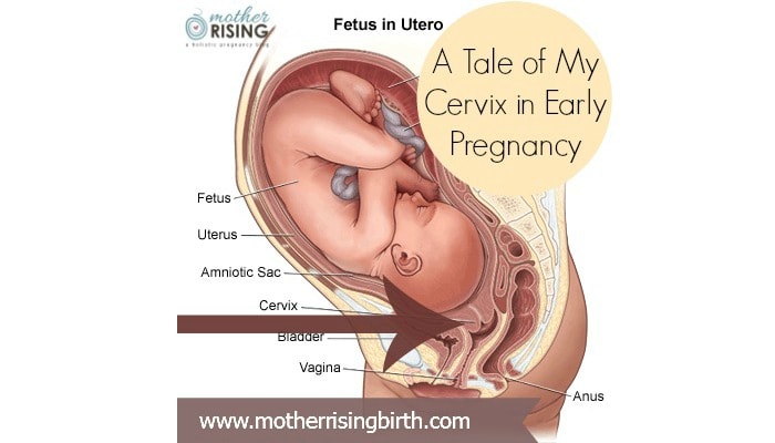 A Tale of My Cervix in Early Pregnancy