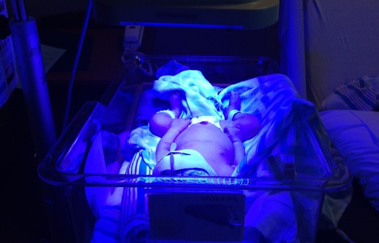 Baby Friendly Jaundice Treatment Tips