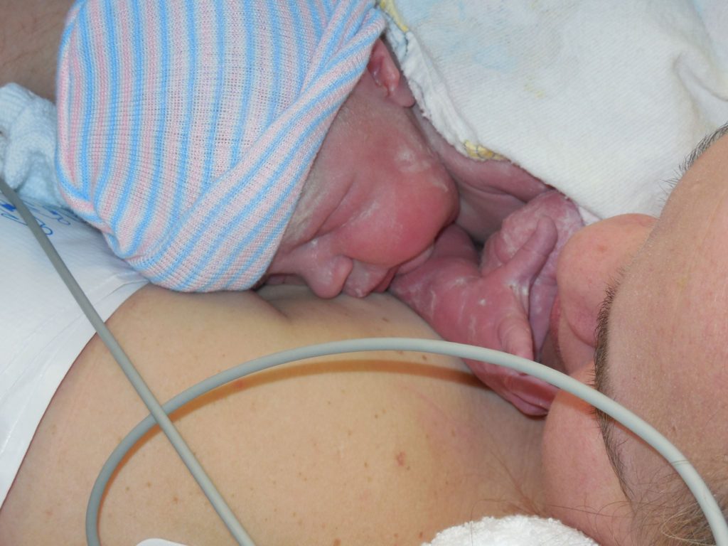 skin to skin in the or for a gentle c section delivery