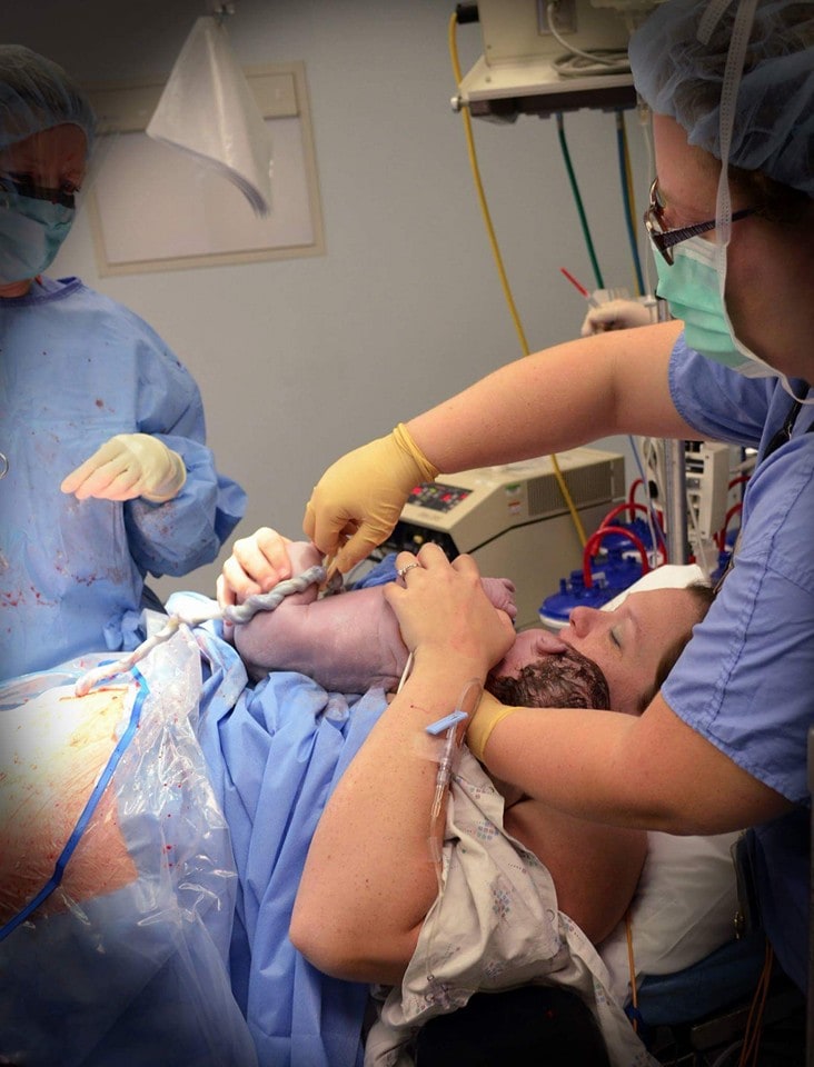 A gentle c section is a cesarean birth that is heavily focused on supporting the new family throughout the birth process and less on traditional medical procedures and protocol. Here's how to make it happen!