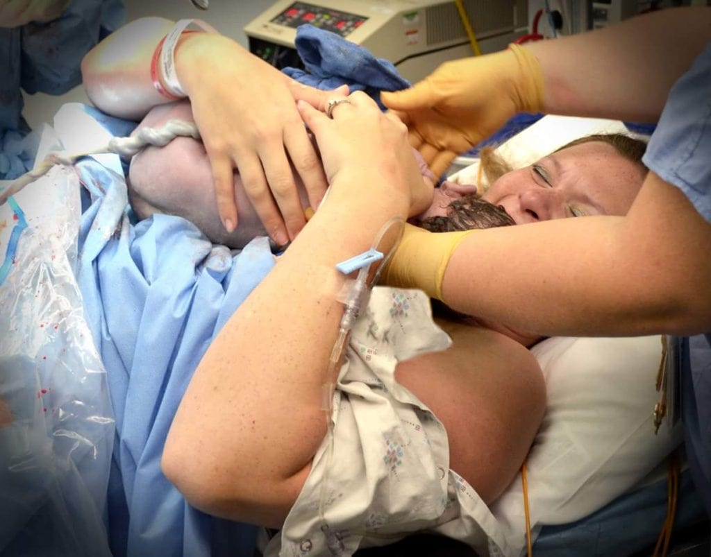 woman with baby on chest after cesarean delivery