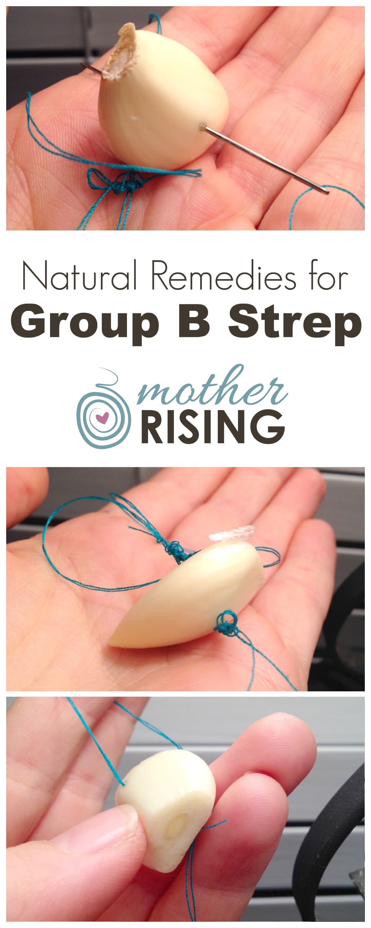 This is the ultimate guide to natural remedies for Group B Strep in pregnancy!!