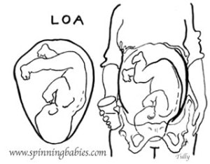 loa-web_-300x234