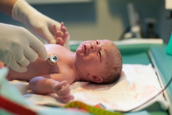 newborn baby being assessed 