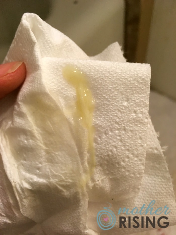 What Does a Mucus Plug Look Like? This one looks a snot like, yellow, mucus plug