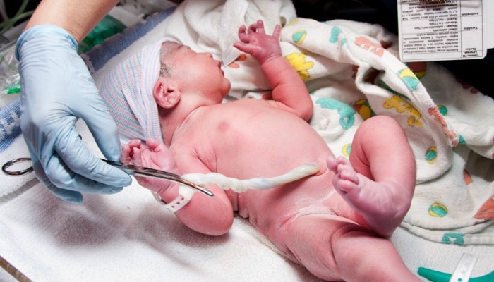 newborn baby with cord cut with scissors 