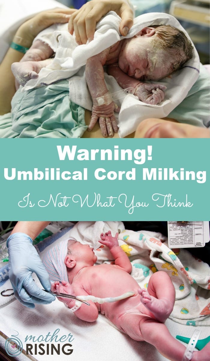 Umbilical cord milking is where the cord is pinched and "milked" immediately following birth in order to quickly push blood into the baby (as you would squeeze ketchup out of a packet, or honey out of a honey stick).  Starting as close to the placenta as possible, moving towards the baby, a care provider milks the cord several times before the cord is finally clamped and cut, usually within 20 seconds.  Umbilical cord milking is also sometimes called "stripping the cord".