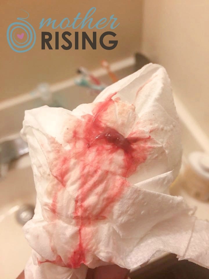 This mucus plug photo in labor looks like more blood - pink and sometimes slightly red.