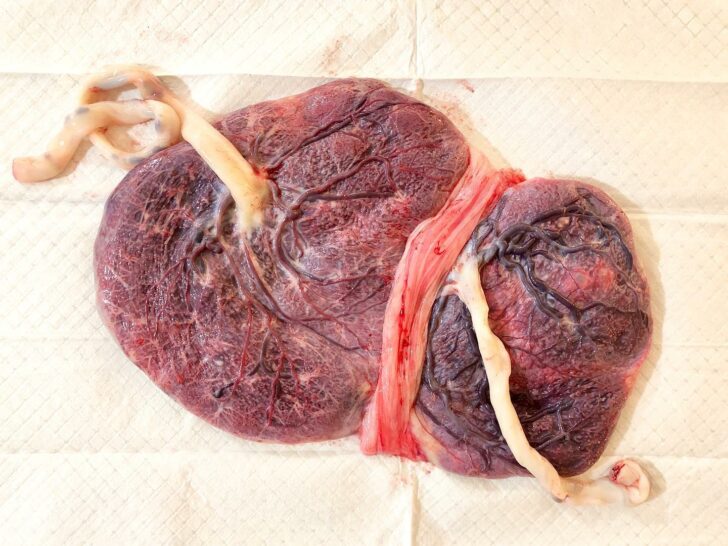 Picture of 2 red and pink twin placentas with white umbilical cords on a white background. Twin placentas will increase the cost of placenta encapsulation. 