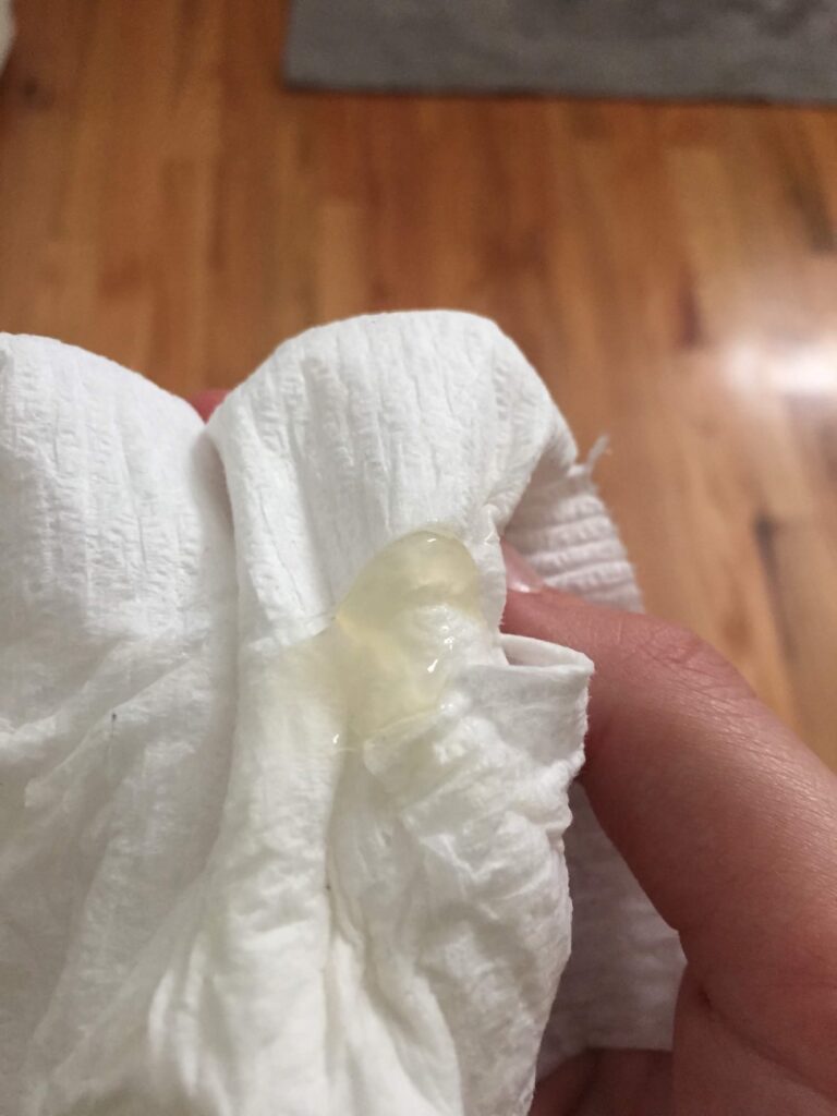 A mucus plug photo in pregnancy looks like clear jelly, with a yellowish tint that is somewhat clear, in the shape of a tube.