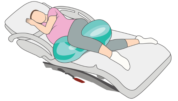 clipart of woman using peanut ball on side during labor in hospital bed