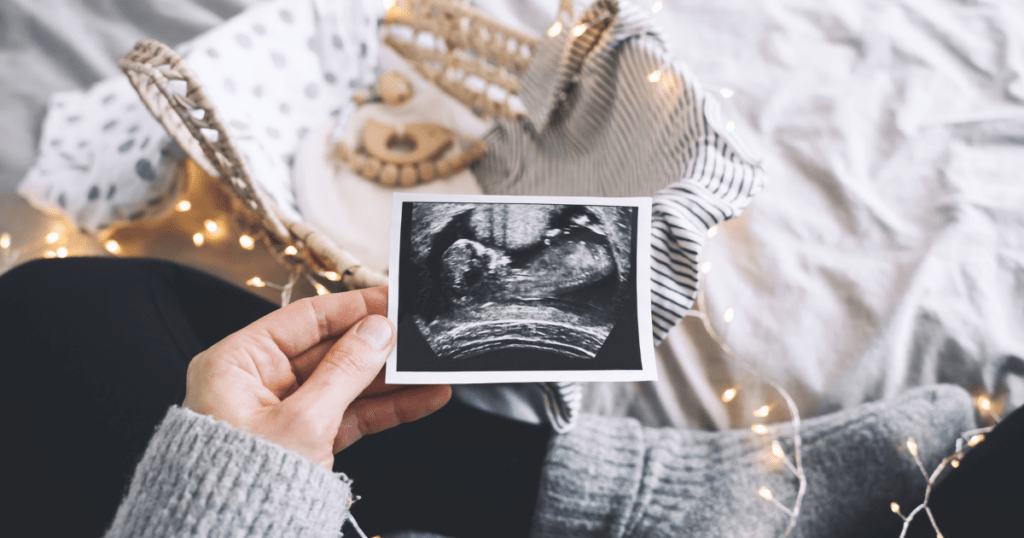 woman holding ultrasound photo on bed near other baby objects and fairy lights