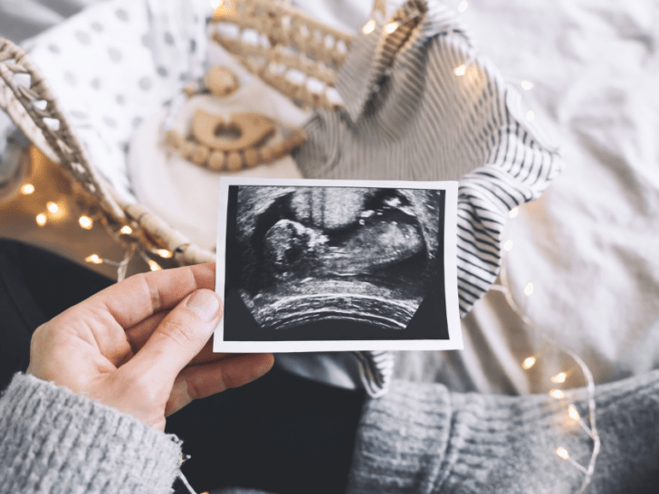 woman holding ultrasound photo on bed near other baby objects and fairy lights